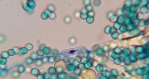 Peneliti Temukan Pewarna Yang Aman dan Efektif untuk Mengobati Malaria