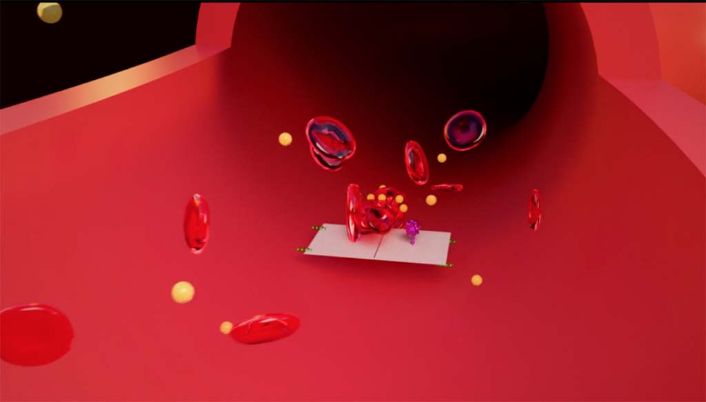 Memberantas Kanker dengan Nanorobot