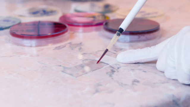 Ilmuwan Telah Menentukan Asal Usul Anemia Sel Sabit