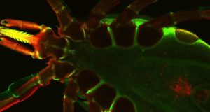 Peneliti mengungkap protein yang digunakan untuk mengakali sistem kekebalan tubuh manusia