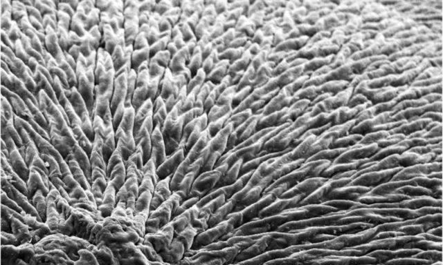 Bahan yang Bisa Meregenerasi Email Gigi yang Dikembangkan Para Ilmuwan