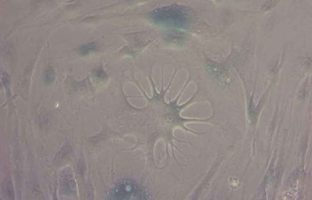 Senyawa baru dapat membalikkan penuaan sel manusia