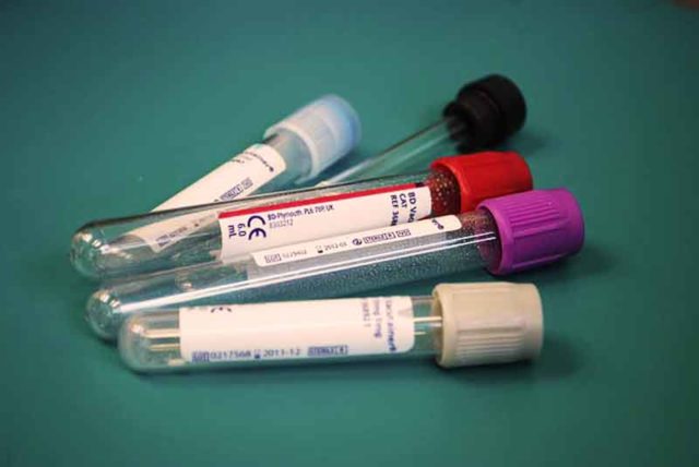 Bahan kimia yang dapat membunuh sel kanker ganas