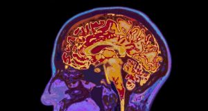 Otak mengungkapkan pilihan sebelum kita menyadarinya, demikian temuan studi