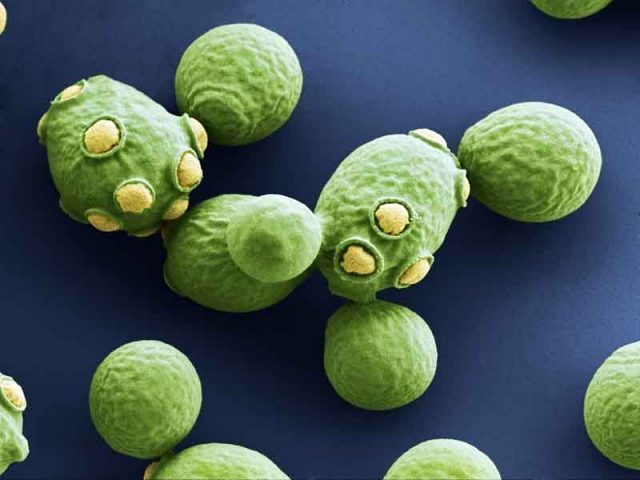 Jamur yang biasanya ditemukan pada kulit mungkin berperan dalam penyakit Crohn