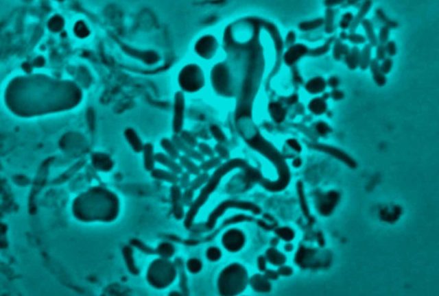 Penyebab Resistensi Antibiotik Teridentifikasi