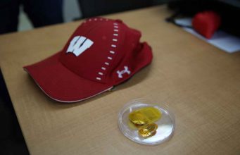 Mengatasi Kebotakan Dengan Teknologi Listrik