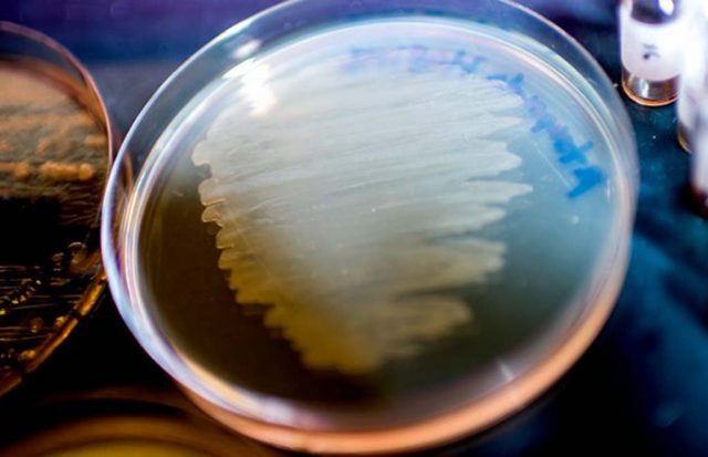 Antibiotik Superbug Ditemukan dari Sejenis Cacing