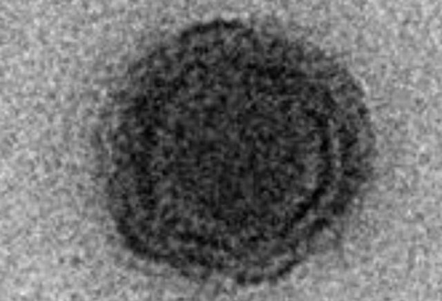 90% Gen Dalam Virus ini Tidak Diketahui dan Dianggap Unik