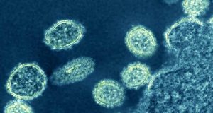 Flu Babi Jenis Baru yang Dapat Memicu Pandemi Baru, Ditemukan di China