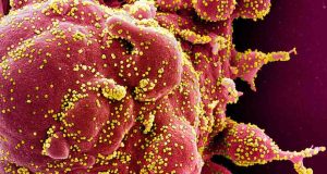 Dapatkah Vaksin Mengalahkan Kecepatan Mutasi Virus SARS-CoV-2