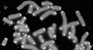 Mengembalikan Sebagian Proses Penuaan Sel pada Manusia Kromosom manusia (abu-abu) yang dibatasi oleh telomer (putih) (Wikimedia)