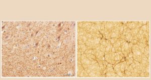 Ada Kemiripan Antara Otak Manusia dengan Alam Semesta Credit: University of Bologna