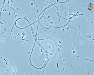 Flexibacter – pengurai polisakarida